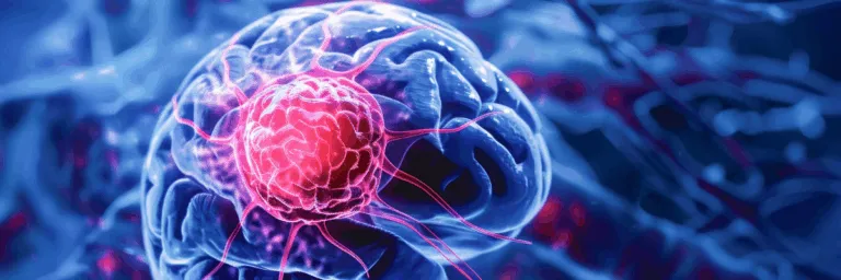 Esclerose múltipla: o potencial das células mesenquimais na modulação da resposta do sistema imunitário